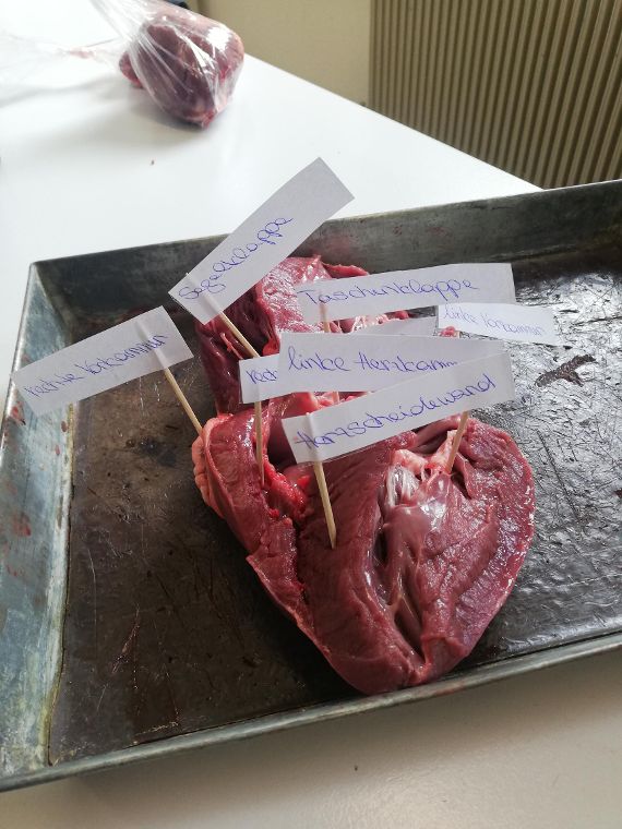 Anatomie des Herzens